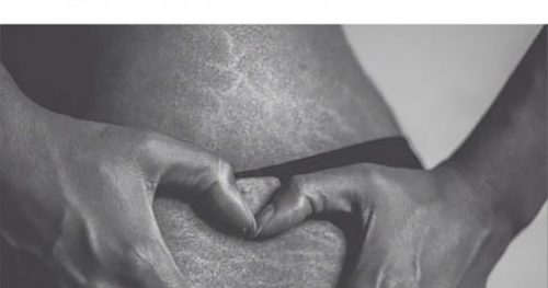6 "imperfections" féminines que les hommes trouvent absolument sexy ! 15 Source : http://www.cosmopolitan.fr/,loveyourlines-le-hashtag-pour-faire-la-paix-avec-nos-vergetures,1916662.asp